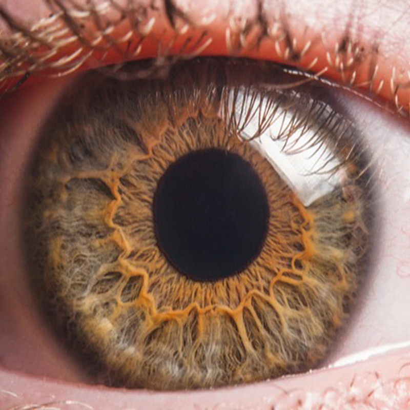 Keratoplasties