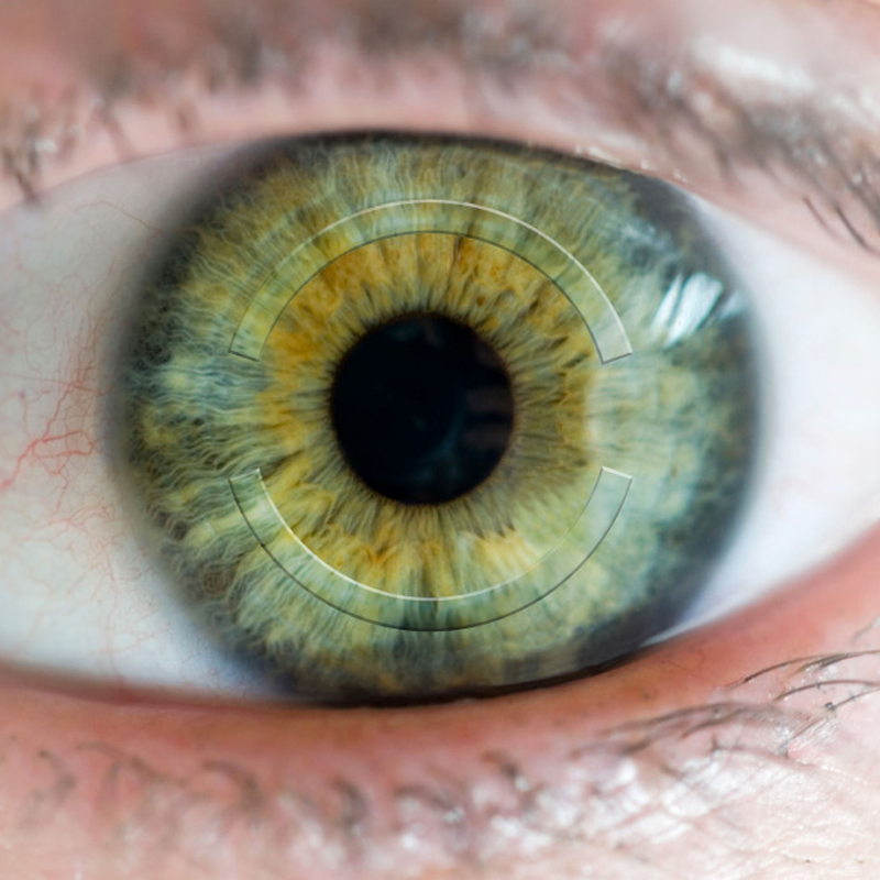 Ocular Surface Disorders